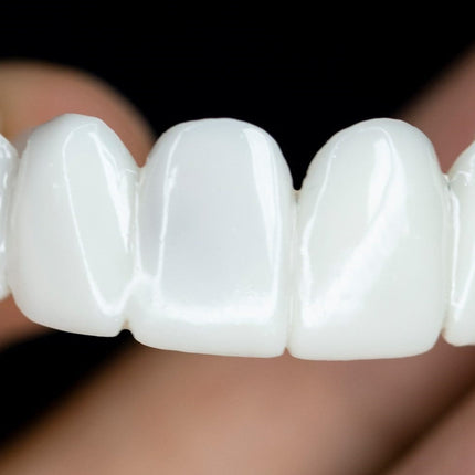 Proteza stomatologiczna z możliwością dopasowania i naturalnym wyglądem – lekkie, wielokrotnego użytku soczewki stomatologiczne 3