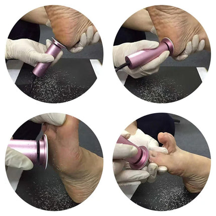 Urządzenie do Pielęgnacji Stóp z Regulowaną Prędkością – 60 Wymiennych Podkładek, Bezprzewodowe, Aluminium, Różowe, Złote, Czarny, Szary 2